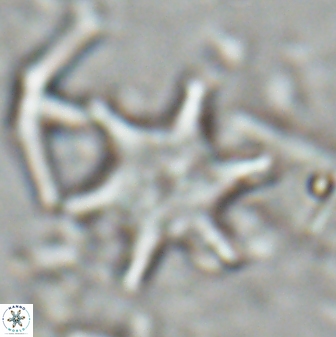 Discoaster shumenkoi 27002
