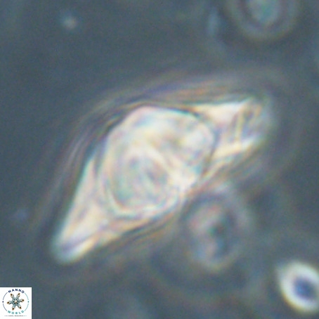 Discoaster sp 5 VR 29542