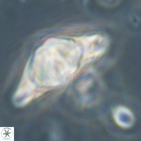Discoaster sp 5 VR 29543