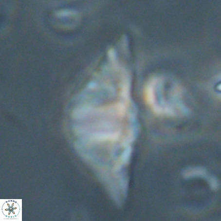 Discoaster sp 5 VR 29544