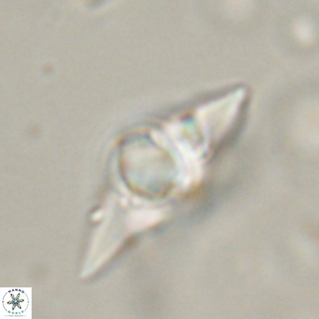 Discoaster sp 5 VR 29545