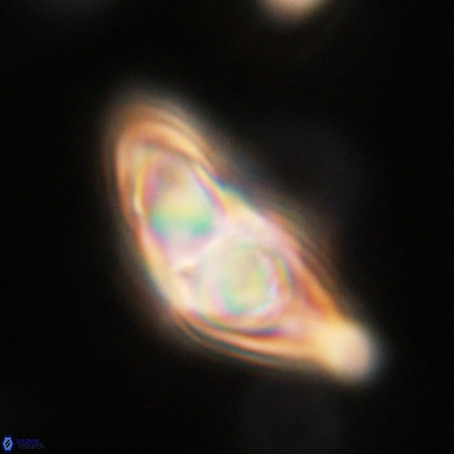 Discoaster sp 5 VR 29551
