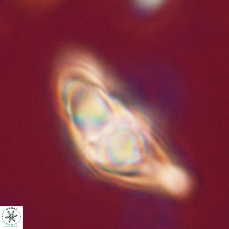 Discoaster sp 5 VR 29552