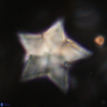 Discoaster sp 5 VR 29558