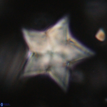 Discoaster sp 5 VR 29562