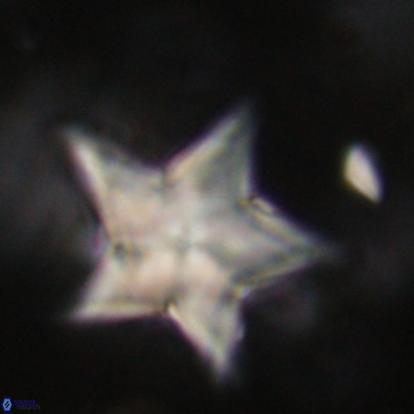 Discoaster sp 5 VR 29565