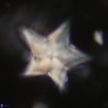 Discoaster sp 5 VR 29566