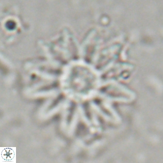 Discoaster splendidus 23345