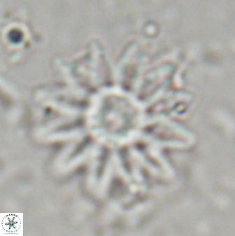 Discoaster splendidus 23346