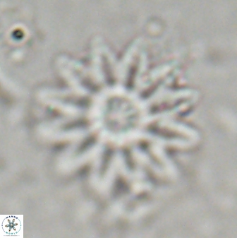 Discoaster splendidus 23347