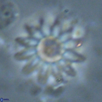 Discoaster splendidus 23348