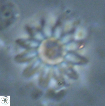Discoaster splendidus 23348