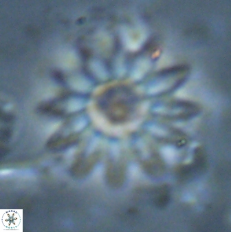 Discoaster splendidus 23349