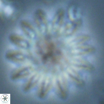 Discoaster splendidus 25785