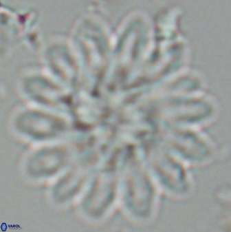 Discoaster splendidus 25788