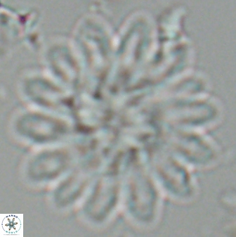 Discoaster splendidus 25788