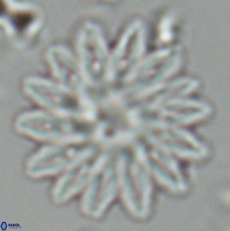 Discoaster splendidus 25789