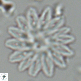 Discoaster splendidus 25789