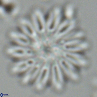 Discoaster splendidus 25790