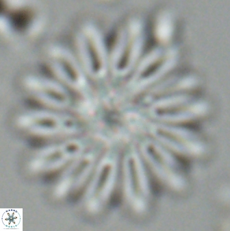 Discoaster splendidus 25790