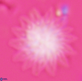 Discoaster splendidus 25791
