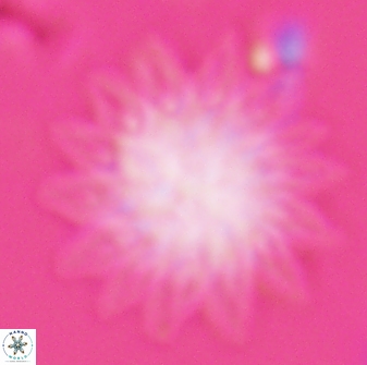 Discoaster splendidus 25791