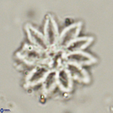 Discoaster splendidus 56205