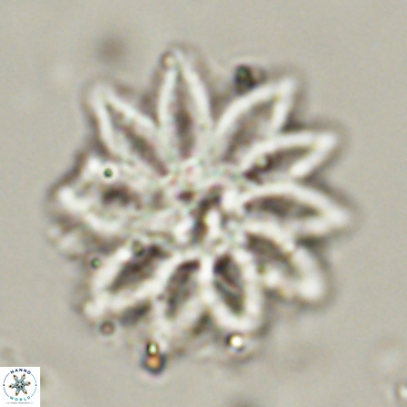 Discoaster splendidus 56205