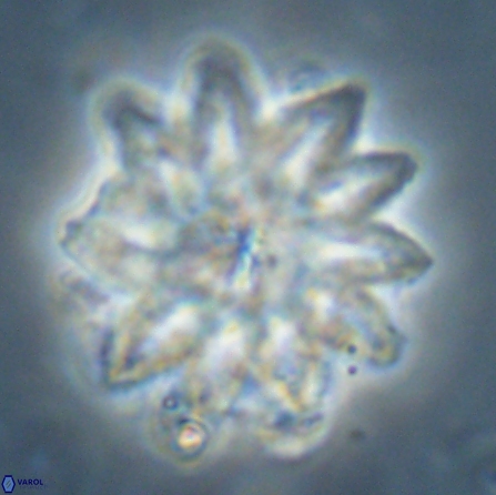 Discoaster splendidus 56207