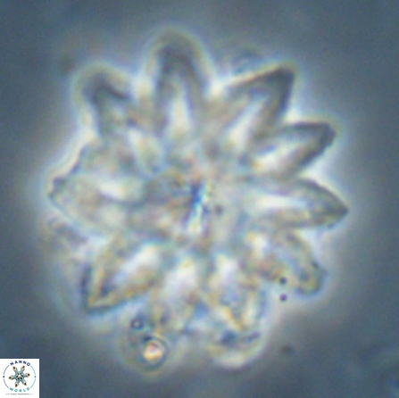 Discoaster splendidus 56207