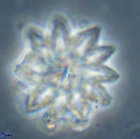 Discoaster splendidus 56208
