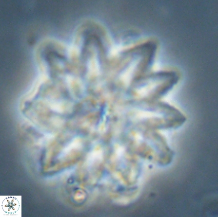 Discoaster splendidus 56208