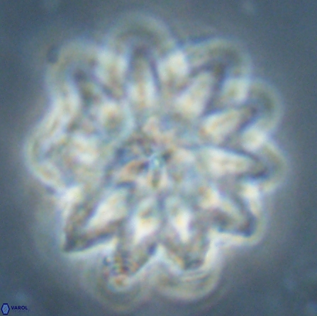 Discoaster splendidus 56209
