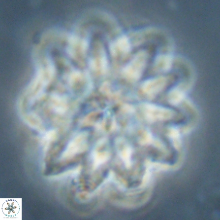 Discoaster splendidus 56209