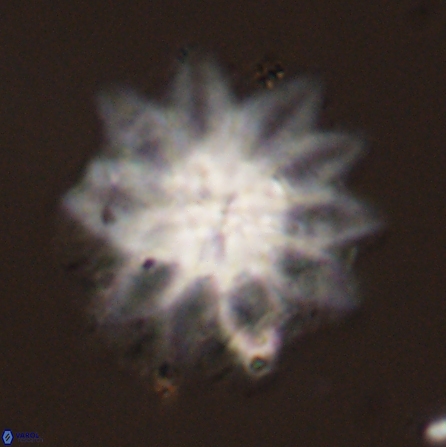 Discoaster splendidus 56211