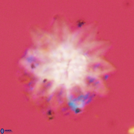 Discoaster splendidus 56212