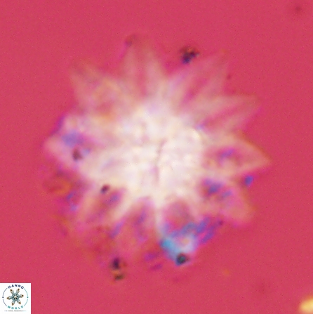 Discoaster splendidus 56212