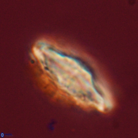 Discoaster splendidus 56213