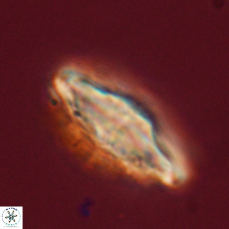 Discoaster splendidus 56213