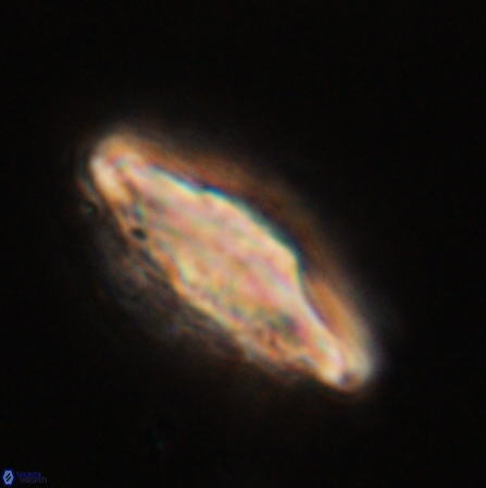Discoaster splendidus 56214
