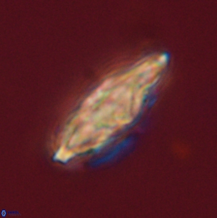 Discoaster splendidus 56216