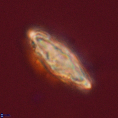 Discoaster splendidus 56217