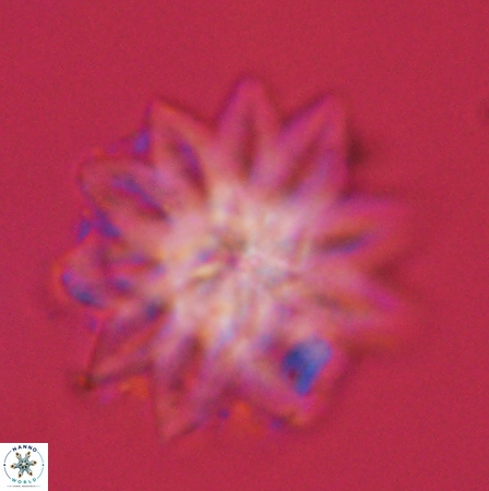 Discoaster splendidus 56221