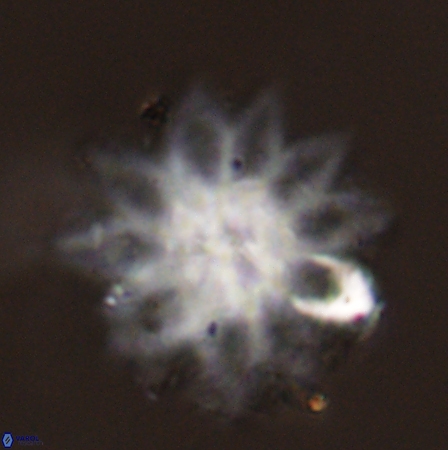 Discoaster splendidus 56222
