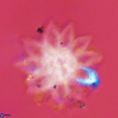 Discoaster splendidus 56223