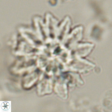 Discoaster splendidus 57120