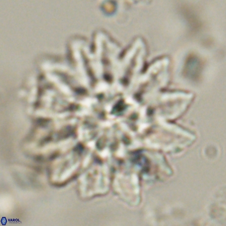 Discoaster splendidus 57121