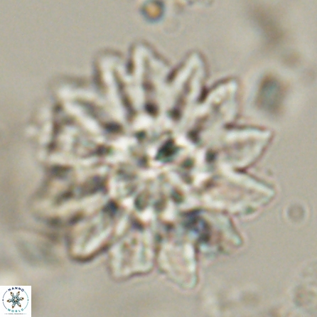 Discoaster splendidus 57121