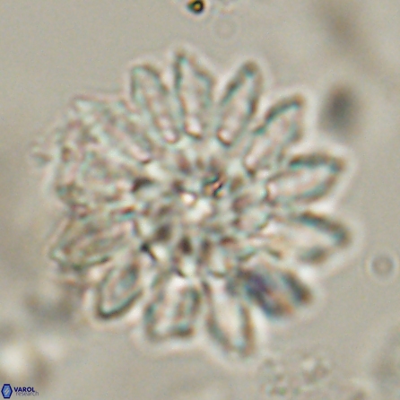 Discoaster splendidus 57122