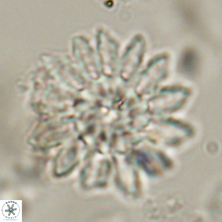 Discoaster splendidus 57122